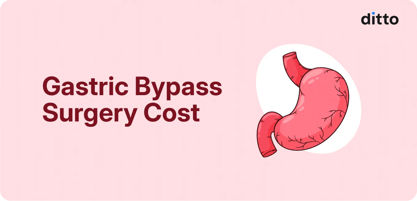 Gastric Bypass Surgery Cost