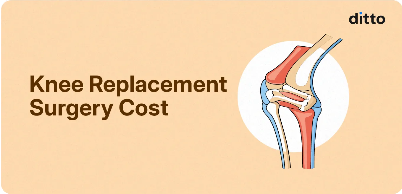 Knee Replacement Surgery Cost